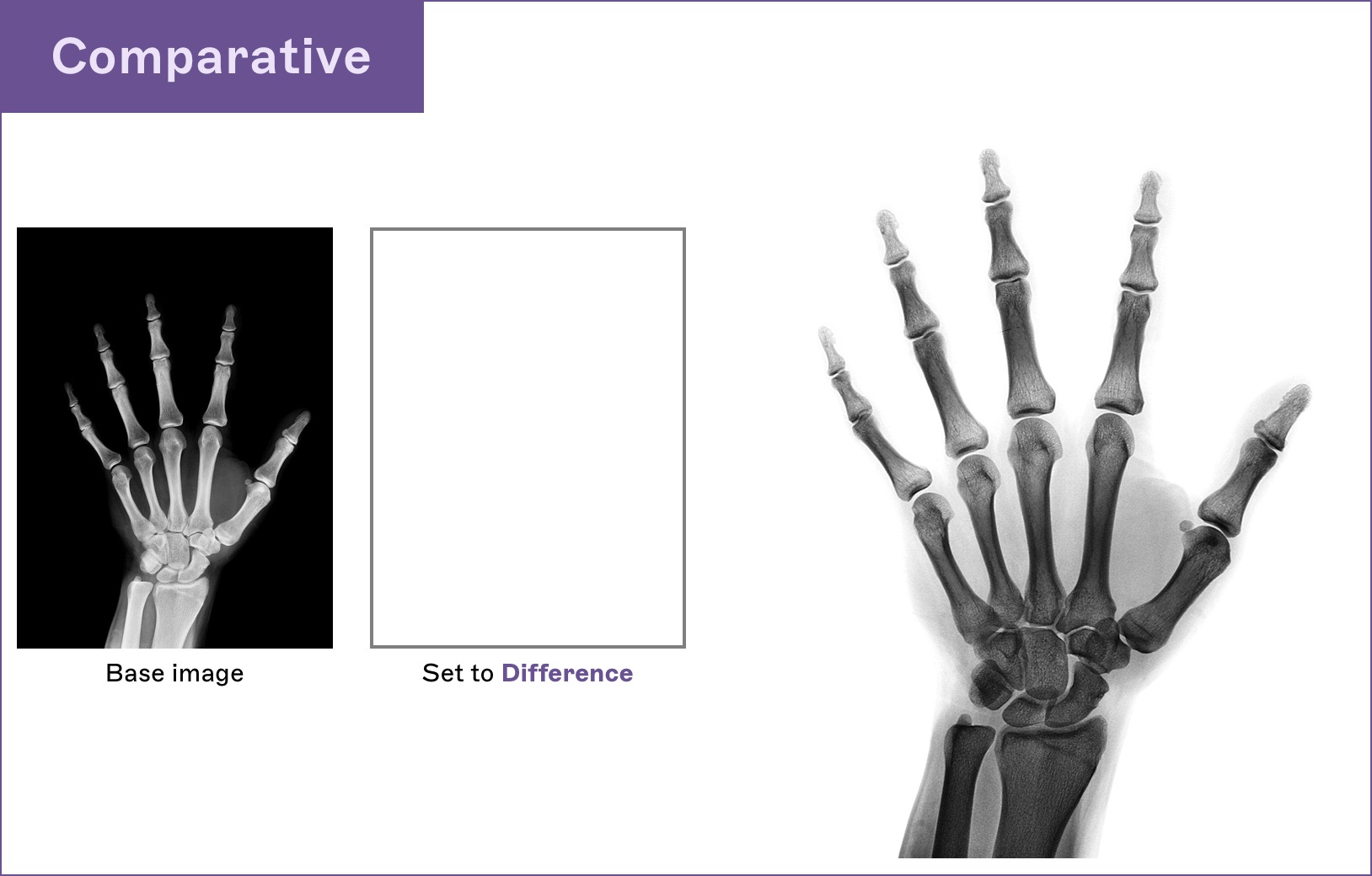 Image showing how to use comparative blend mode to flip the colors in an x-ray in Sketch